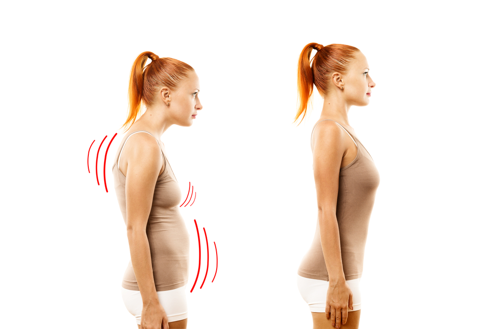 a side-by-side comparison of a woman with poor posture next to the same woman with good posture